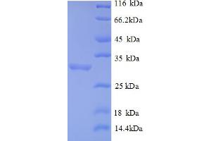 SDS-PAGE (SDS) image for Forkhead Box P3 (FOXP3) (AA 1-260), (partial) protein (His tag) (ABIN5712964)