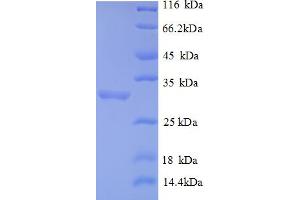 SDS-PAGE (SDS) image for Forkhead Box P3 (FOXP3) (AA 1-260), (partial) protein (His tag) (ABIN5712964) (FOXP3 Protein (AA 1-260, partial) (His tag))