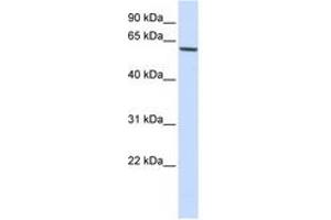 Image no. 1 for anti-Forkhead Box O4 (FOXO4) (AA 108-157) antibody (ABIN6744334) (FOXO4 anticorps  (AA 108-157))
