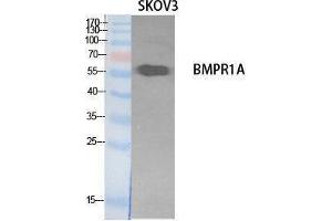 Western Blotting (WB) image for anti-Bone Morphogenetic Protein Receptor 1A (BMPR1A) (Internal Region) antibody (ABIN3178544) (BMPR1A anticorps  (Internal Region))