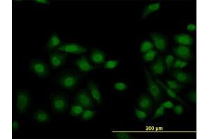 Image no. 1 for anti-Lysine (K)-Specific Demethylase 5B (KDM5B) (AA 231-320) antibody (ABIN599151) (KDM5B anticorps  (AA 231-320))