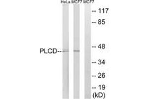 Western Blotting (WB) image for anti-1-Acylglycerol-3-Phosphate O-Acyltransferase 4 (AGPAT4) (AA 151-200) antibody (ABIN2890034) (AGPAT4 anticorps  (AA 151-200))