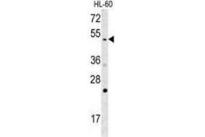 Western blot analysis in HL-60 cell line lysates (35ug/lane) using NOS1AP  Antibody . (NOS1AP anticorps  (Middle Region))