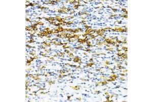 Immunohistochemistry of paraffin-embedded human tonsil using SNRNP70 antibody.