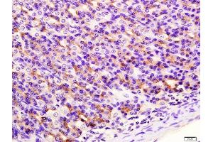 Paraformaldehyde-fixed, paraffin embedded rat stomach tissue, Antigen retrieval by boiling in sodium citrate buffer(pH6) for 15min, Block endogenous peroxidase by 3% hydrogen peroxide for 30 minutes, Blocking buffer (normal goat serum) at 37°C for 20min, Antibody incubation with Rabbit Anti-SIRT4 Polyclonal Antibody, Unconjugated  at 1:400 overnight at 4°C, followed by a conjugated secondary and DAB staining