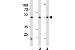 HNF4A antibody western blot analysis in 1) 293, 2) HepG2 cell line and 3) rat liver tissue lysate. (HNF4A anticorps  (AA 281-312))