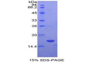 SDS-PAGE analysis of Human NME4 Protein. (Non Metastatic Cells 4, Protein NM23A Expressed In Protéine)