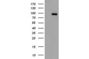 Western Blotting (WB) image for anti-CUB Domain Containing Protein 1 (CDCP1) antibody (ABIN1497413) (CDCP1 anticorps)