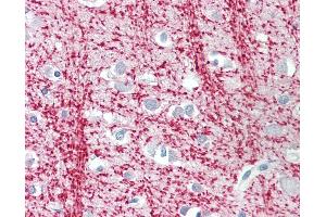 Anti-TPPP antibody IHC staining of human brain, cortex. (Tppp anticorps  (AA 21-35))