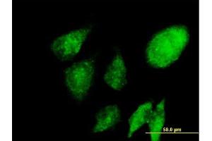 Immunofluorescence of purified MaxPab antibody to NACA on HeLa cell.