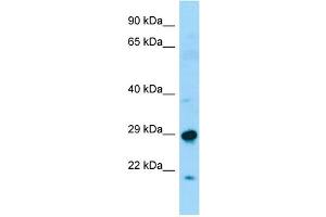 WB Suggested Anti-SPAG7 Antibody Titration: 1. (SPAG7 anticorps  (N-Term))