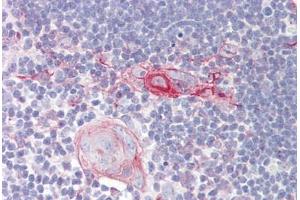 Image no. 2 for anti-Interleukin 28 Receptor, alpha (Interferon, lambda Receptor) (IL28RA) (AA 51-100) antibody (ABIN6749738)