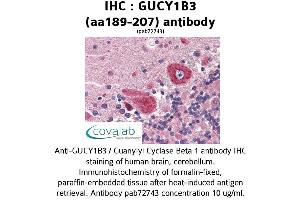 Image no. 1 for anti-Guanylate Cyclase 1, Soluble, beta 3 (GUCY1B3) (AA 189-207) antibody (ABIN2852385) (GUCY1B3 anticorps  (AA 189-207))
