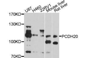 Western blot analysis of extracts of various cell lines, using PCDH20 antibody (ABIN5998470) at 1/1000 dilution. (PCDH20 anticorps)