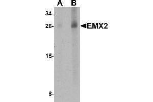 Western blot analysis of EMX2 in human lung tissue lysate with EMX2 antibody at (A) 1 and (B) 2 µg/mL. (EMX2 anticorps  (Middle Region))