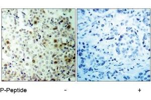 Image no. 1 for anti-Cyclin-Dependent Kinase 2 (CDK2) (pThr160) antibody (ABIN196844) (CDK2 anticorps  (pThr160))