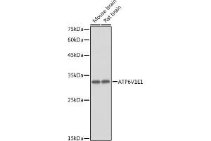 Western blot analysis of extracts of various cell lines, using V1E1 antibody (ABIN1678795, ABIN3018056, ABIN3018057 and ABIN6220346) at 1:1000 dilution. (ATP6V1E1 anticorps  (AA 77-226))
