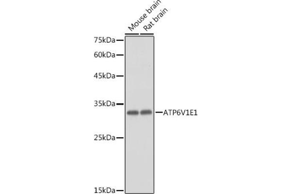ATP6V1E1 antibody  (AA 77-226)