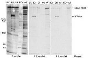 Image no. 1 for anti-Lysine (K)-Specific Methyltransferase 2A (KMT2A) (AA 720-780), (N-Term) antibody (ABIN328575) (Lysine (K)-Specific Methyltransferase 2A (KMT2A) (AA 720-780), (N-Term) anticorps)