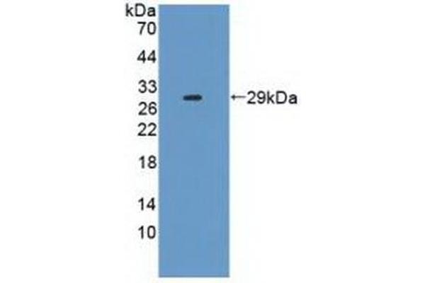 CD25 antibody  (AA 22-213)