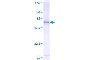 Image no. 1 for Ficolin (Collagen/fibrinogen Domain Containing) 3 (Hakata Antigen) (FCN3) (AA 1-288) protein (GST tag) (ABIN1353914) (FCN3 Protein (AA 1-288) (GST tag))