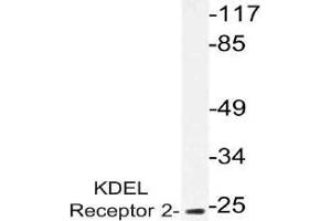 Western blot (WB) analysis of KDEL Receptor 2 antibody in extracts from HUVEC cells. (KDELR2 anticorps)
