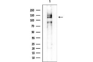anti-Melanoma Antigen Family C, 1 (MAGEC1) (C-Term) antibody
