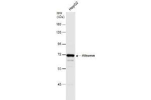 WB Image Whole cell extract (30 μg) was separated by 7. (Albumin anticorps  (C-Term))