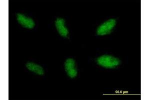 Immunofluorescence of purified MaxPab antibody to NHEJ1 on HepG2 cell.