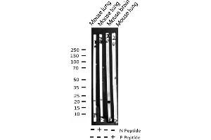 Western blot analysis of Phospho-Stathmin 1 (Ser37) expression in various lysates (Stathmin 1 anticorps  (pSer38))