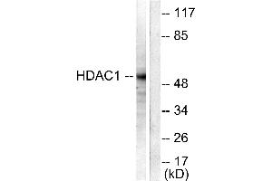 Western blot analysis of extracts from NIH/3T3 cells, using HDAC1 antibody (#C0221). (HDAC1 anticorps)