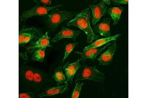 IF analysis of Cyclophilin E/PPIE using anti-Cyclophilin E/PPIE antibody (ABIN7599242). (PPIE anticorps  (AA 1-301))