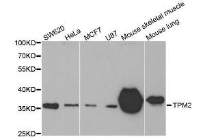 Western blot analysis of extracts of various cell lines, using TPM2 antibody. (TPM2 anticorps)