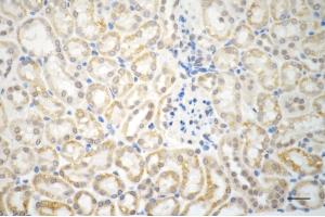 anti-Apoptosis-Inducing Factor, Mitochondrion-Associated, 1 (AIFM1) antibody