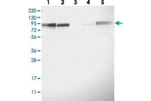 Western blot analysis of Lane 1: RT-4, Lane 2: U-251 MG, Lane 3: Human Plasma, Lane 4: Liver, Lane 5: Tonsil with FAM129B polyclonal antibody  at 1:250-1:500 dilution. (MEG3 anticorps)