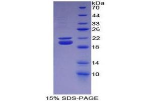 SDS-PAGE of Protein Standard from the Kit (Highly purified E.