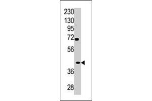 Western blot analysis of TPST2 polyclonal antibody  in A2058 cell line lysate (35 ug/lane). (TPST2 anticorps  (C-Term))