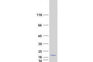 Validation with Western Blot