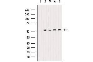 Western blot analysis of extracts from various samples, using PDHX Antibody. (PDHX anticorps)
