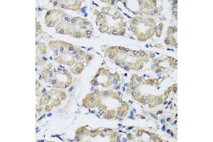 Immunohistochemistry of paraffin-embedded human stomach using SCG3 antibody. (SCG3 anticorps  (AA 199-468))