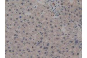 IHC-P analysis of Rat Liver Tissue, with DAB staining. (ICAM2 anticorps  (AA 29-247))