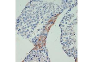 Immunohistochemistry of paraffin-embedded mouse testis using KIF5B antibody (ABIN7268136) at dilution of 1:200 (40x lens).
