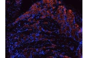 Expression of TrkB in rat DRG - Immunohistochemical staining of rat dorsal root ganglia (DRG) frozen sections using Anti-TrkB (extracellular) Antibody (ABIN7043388, ABIN7044773 and ABIN7044774), (1:100).