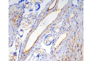IHC analysis of Caveolin-1/CAV1 using anti-Caveolin-1/CAV1 antibody (ABIN6719534). (Caveolin-1 anticorps  (AA 4-178))