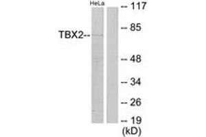 Western blot analysis of extracts from HeLa cells, using TBX2 Antibody. (TBX2 anticorps  (AA 251-300))