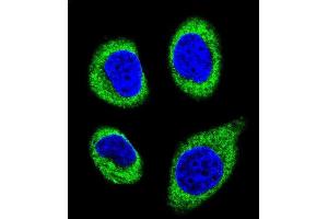 Confocal immunofluorescent analysis of AGBL5 Antibody (N-term) (ABIN655730 and ABIN2845177) with U-251MG cell followed by Alexa Fluor 488-conjugated goat anti-rabbit lgG (green).