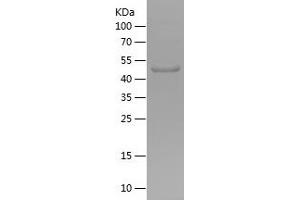 Western Blotting (WB) image for Fucosyltransferase 6 (Alpha (1,3) Fucosyltransferase) (FUT6) (AA 111-332) protein (His-IF2DI Tag) (ABIN7123013)