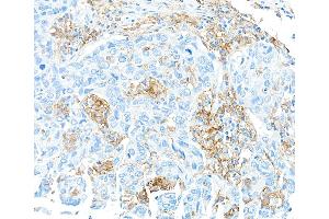 Immunohistochemistry (IHC) image for anti-CD16 (CD16) (AA 21-201) antibody (ABIN7449423) (Recombinant CD16 anticorps  (AA 21-201))