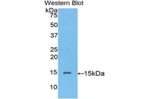 Western blot analysis of the recombinant protein. (Biglycan anticorps  (AA 53-166))