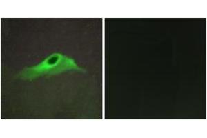 Immunofluorescence analysis of HeLa cells, using Collagen IV alpha5 Antibody.
